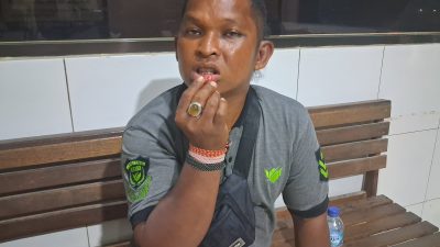Jelang Hari Pers Nasional, Seorang Wartawan di Tapteng Diduga Dipukuli Ajudan Bupati